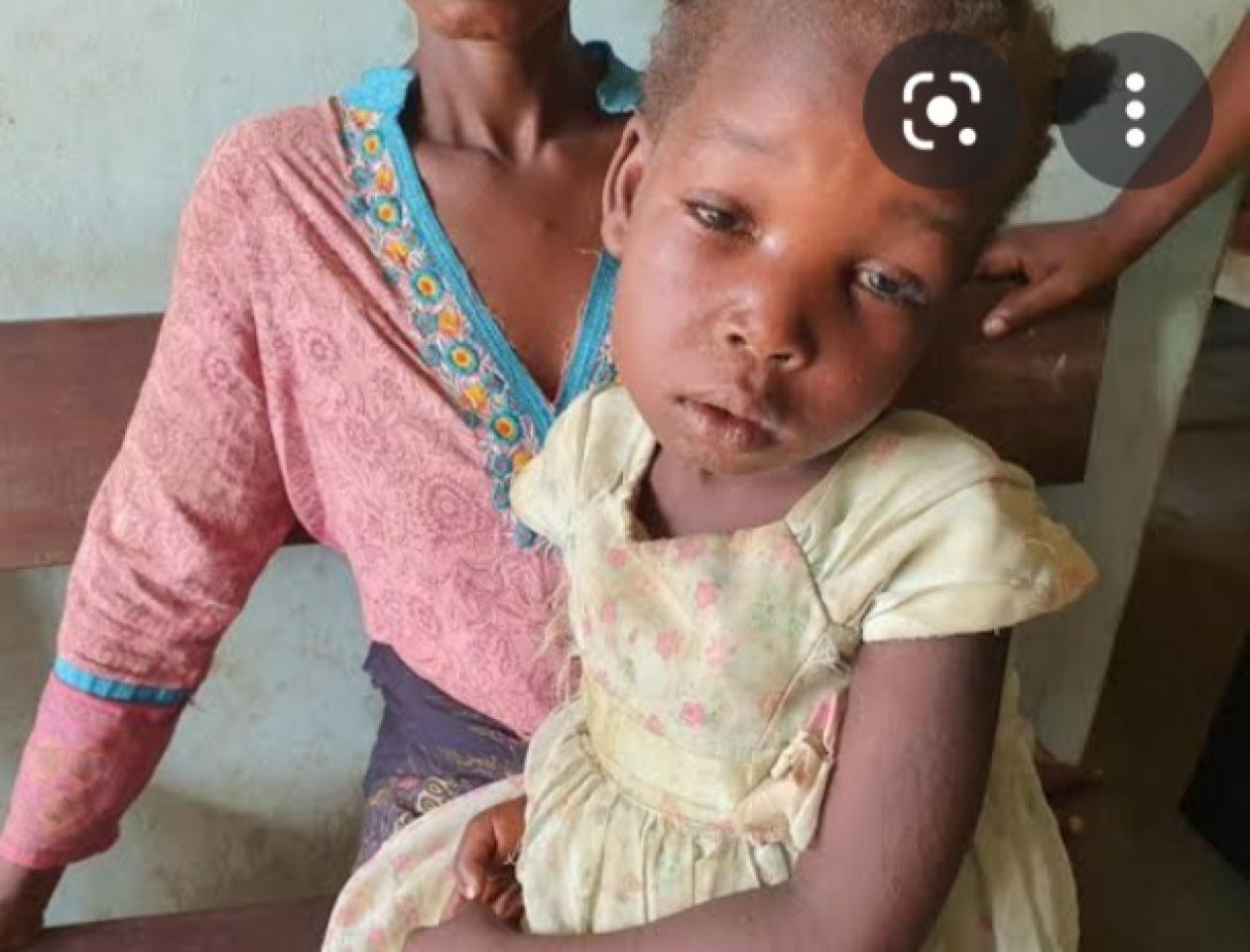 RDC rougeole 